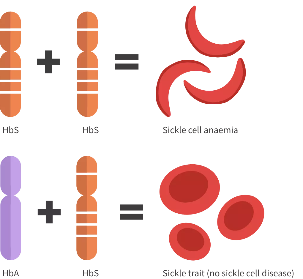 genes showing the difference between sickle cell anaemia vs sickle cell trait
